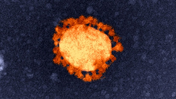 covit-19_virus.jpg